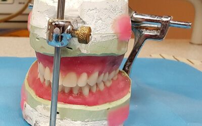 Different Types of Dentures